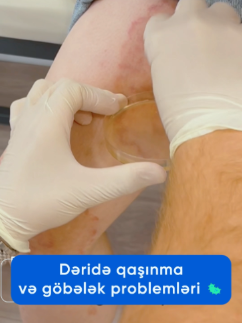 @Dr.Eldar Məmmədov