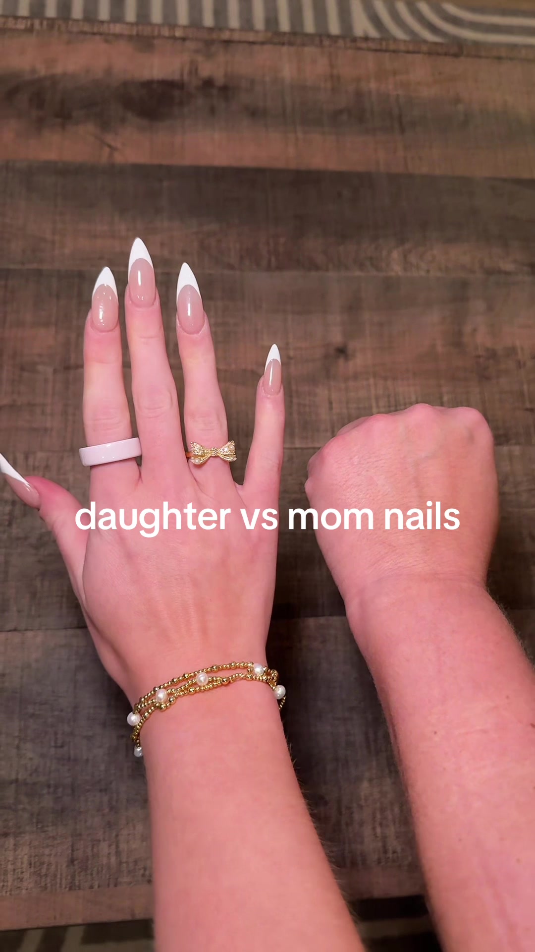 @stormi