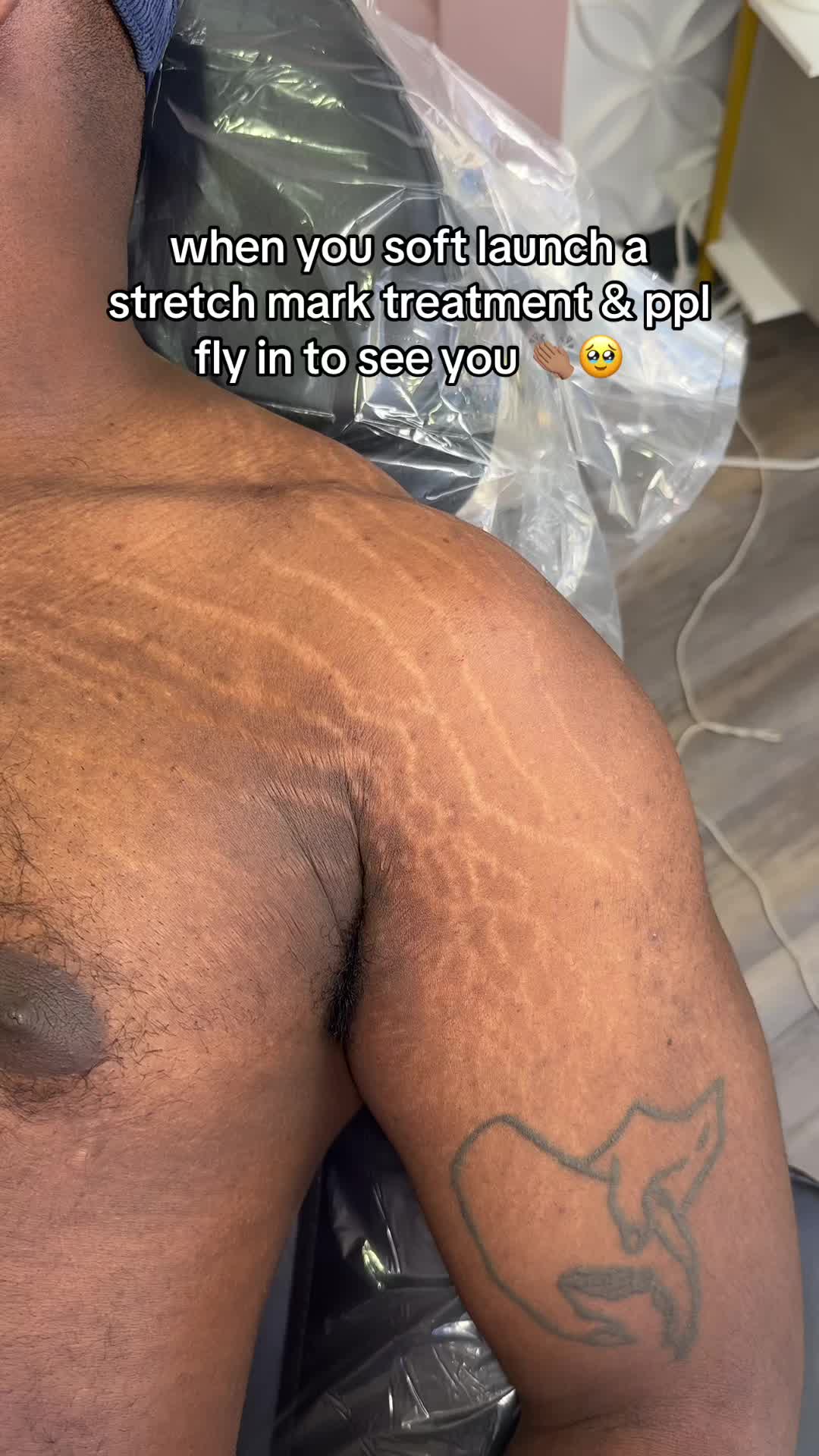 @Stretch Mark Fairy 🧚✨