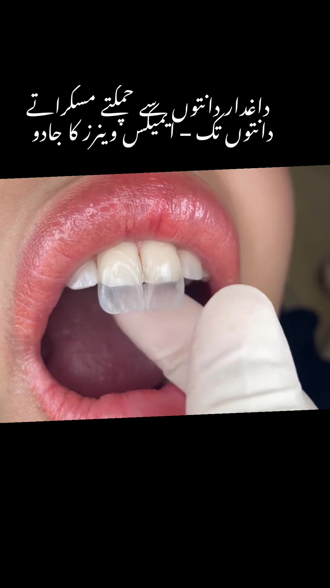 @Dr- syed numan official✅✅