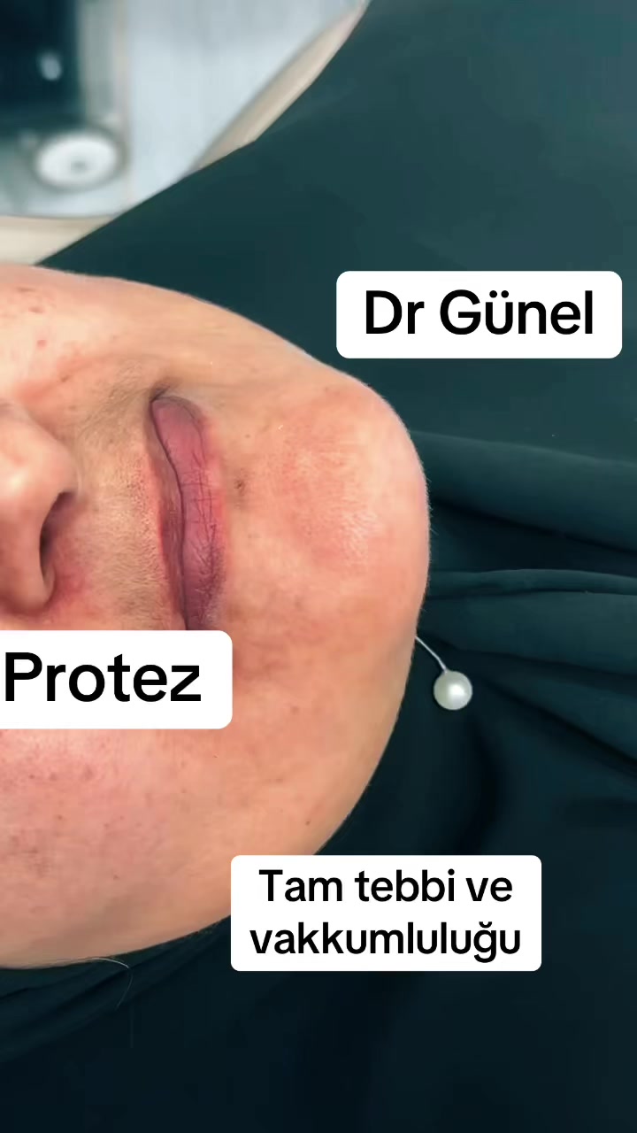 @Dentist_Günel