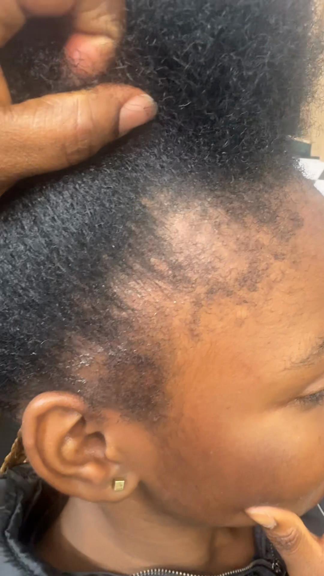 @TINAGOLD BOTANICAL®Hair Growth