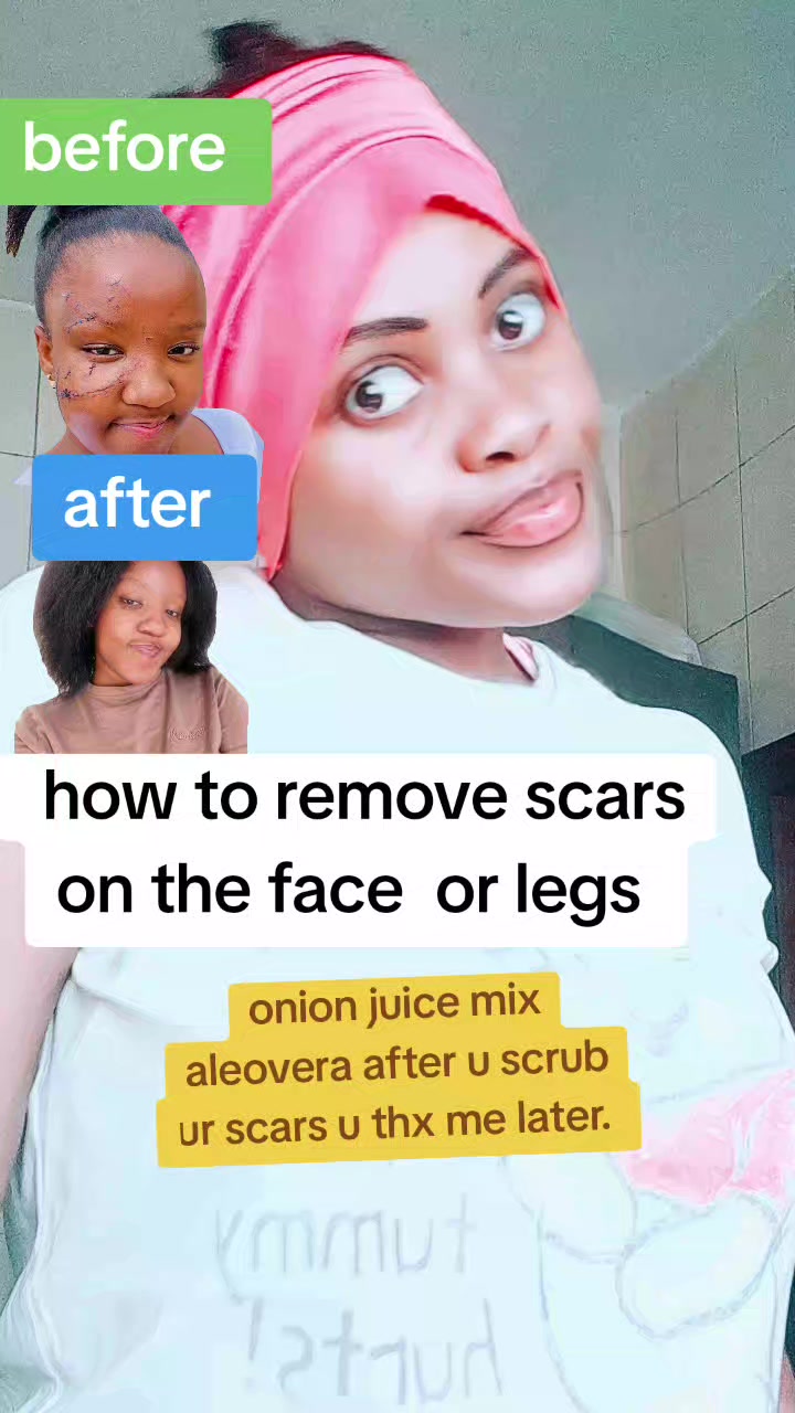 @Anitah Birungi