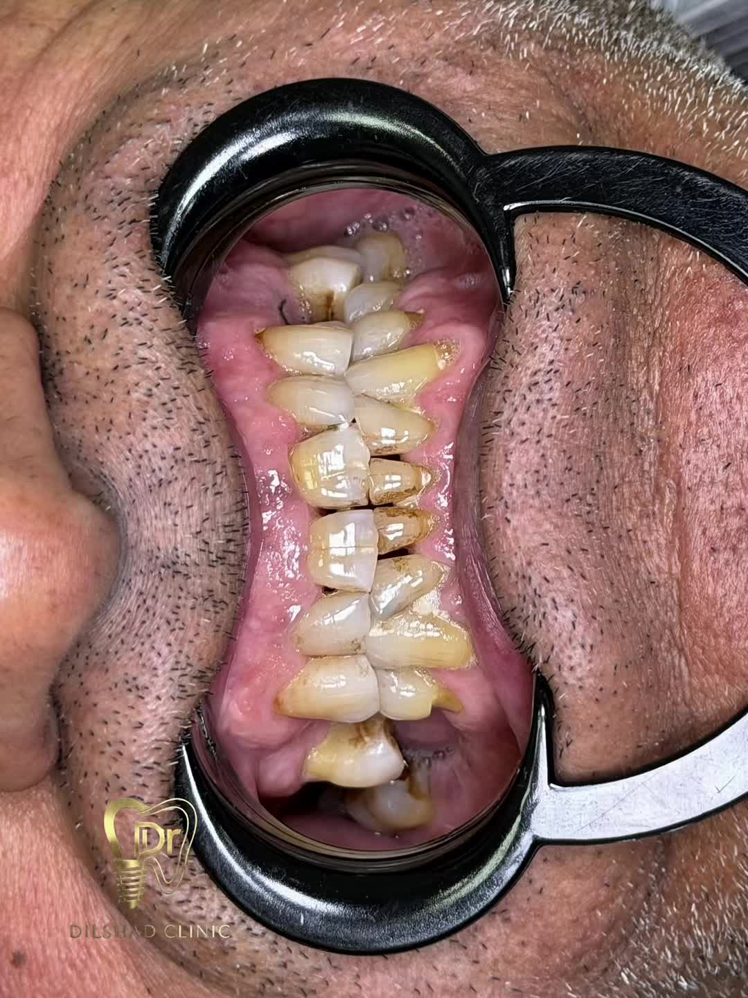 @دكتور دلشاد فيصل