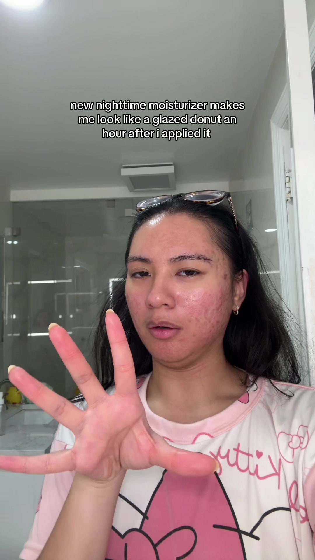 @jennilee &bull; thatacnegirlie