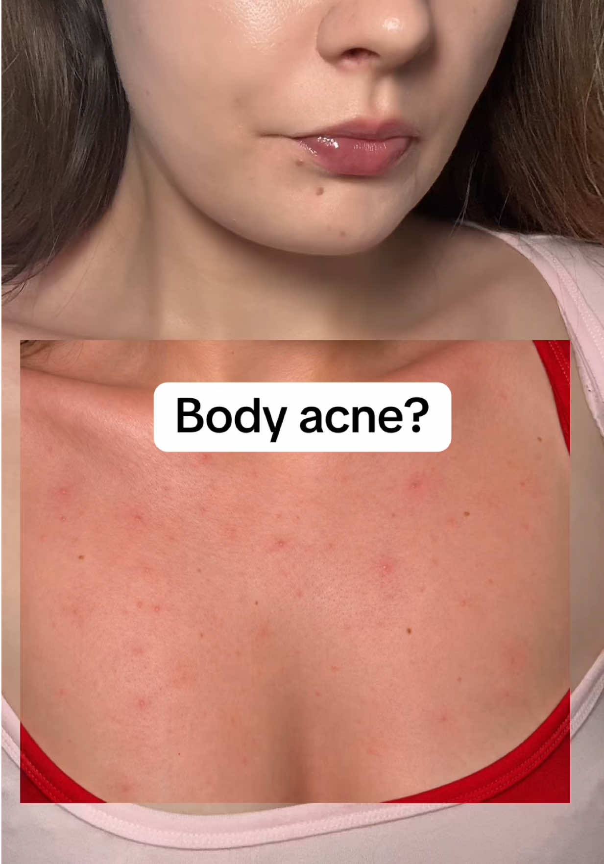 @watermelonsugarskin