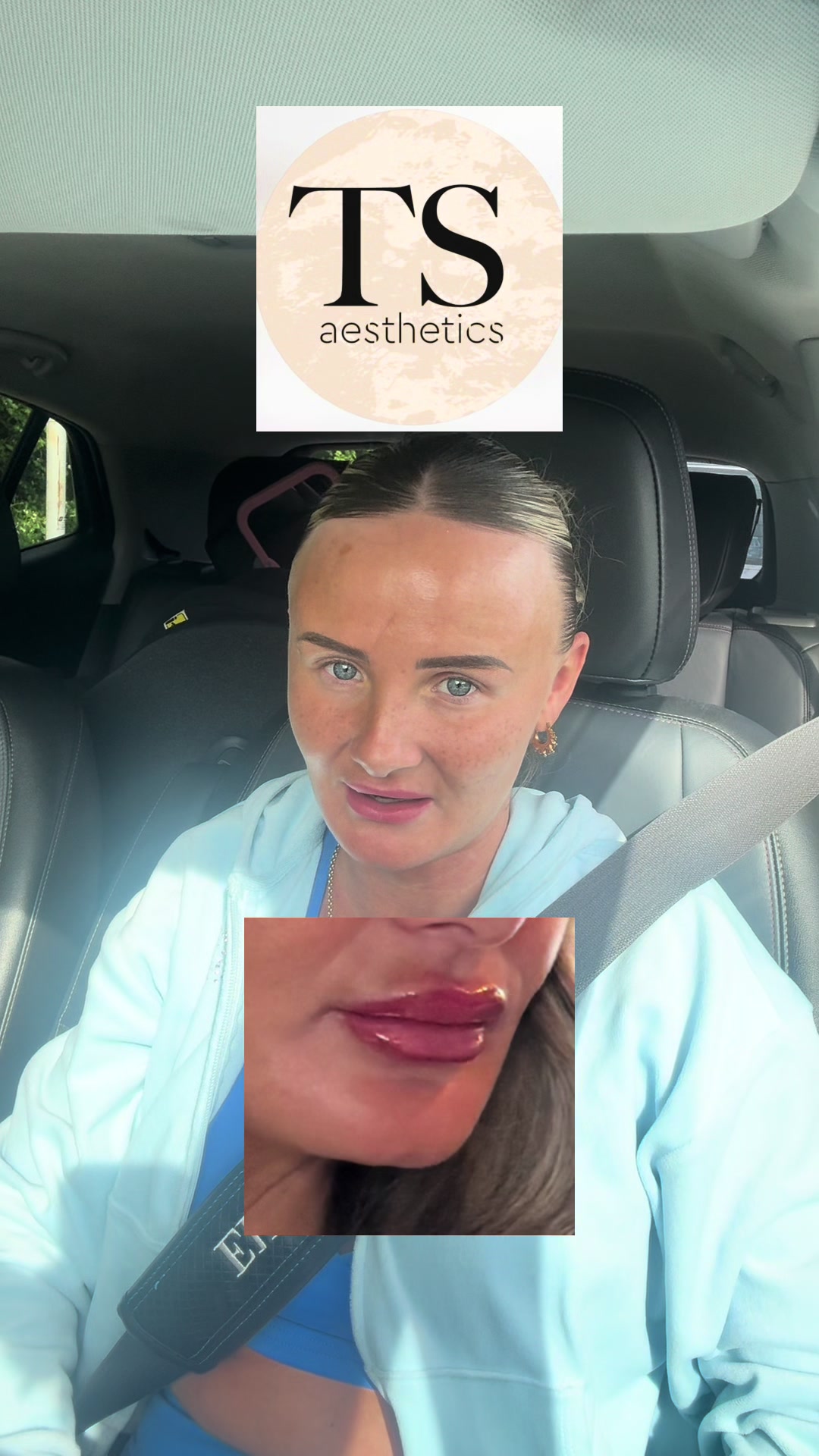 @๐ด๐๐๐๐๐๐๐ ๐ฟ๐๐๐๐๐