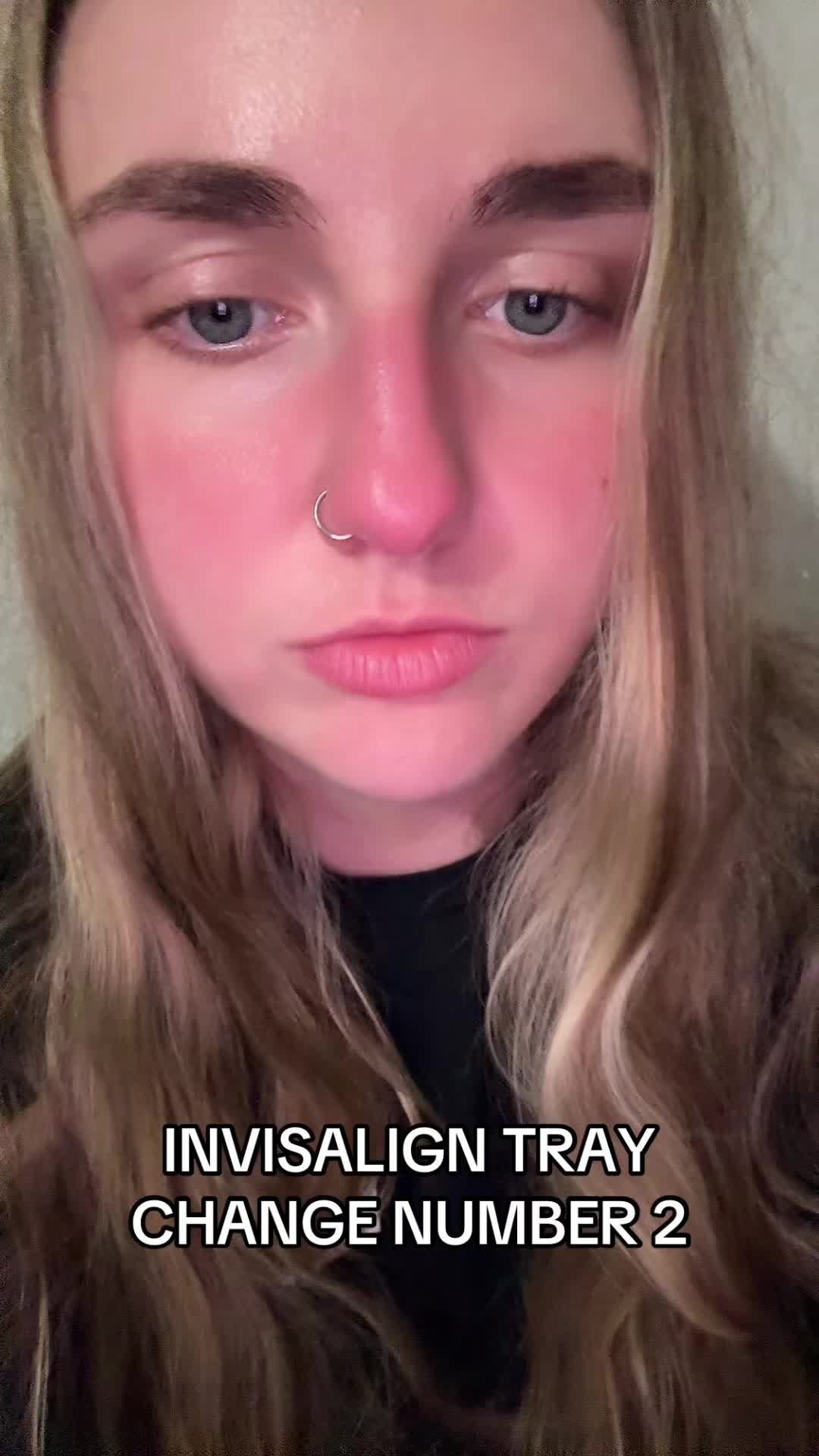 @🦇