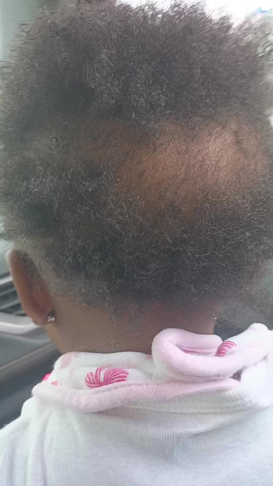 @bald_baddie96