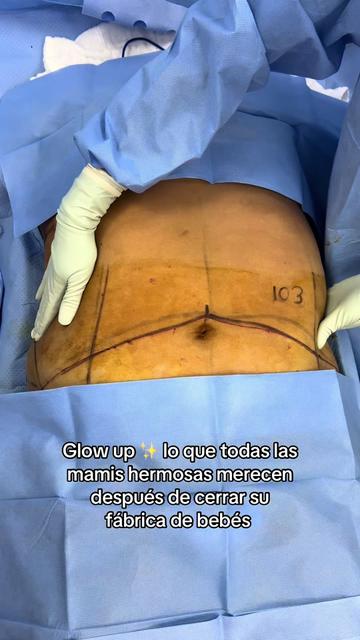 @DR. PARRA