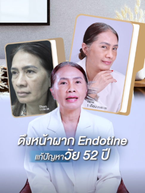 @โรงพยาบาลยันฮี