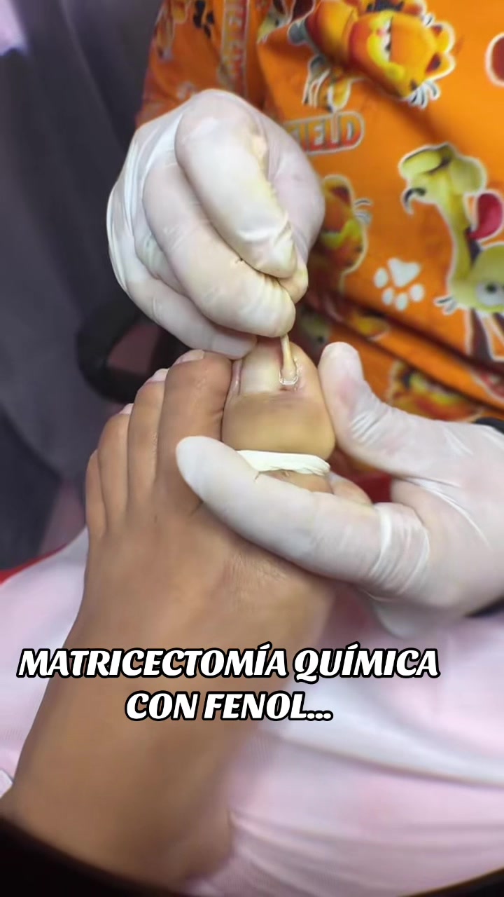 @Podomédical🇵🇪