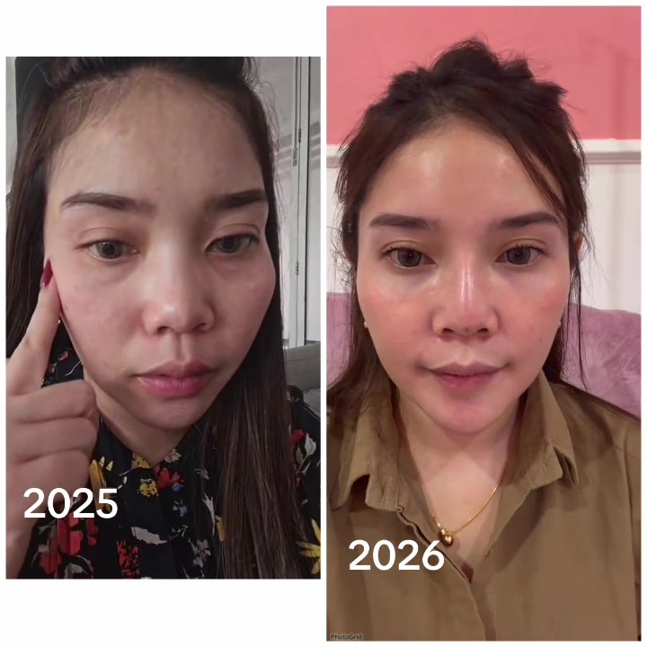 @Hainon Infus Whitening
