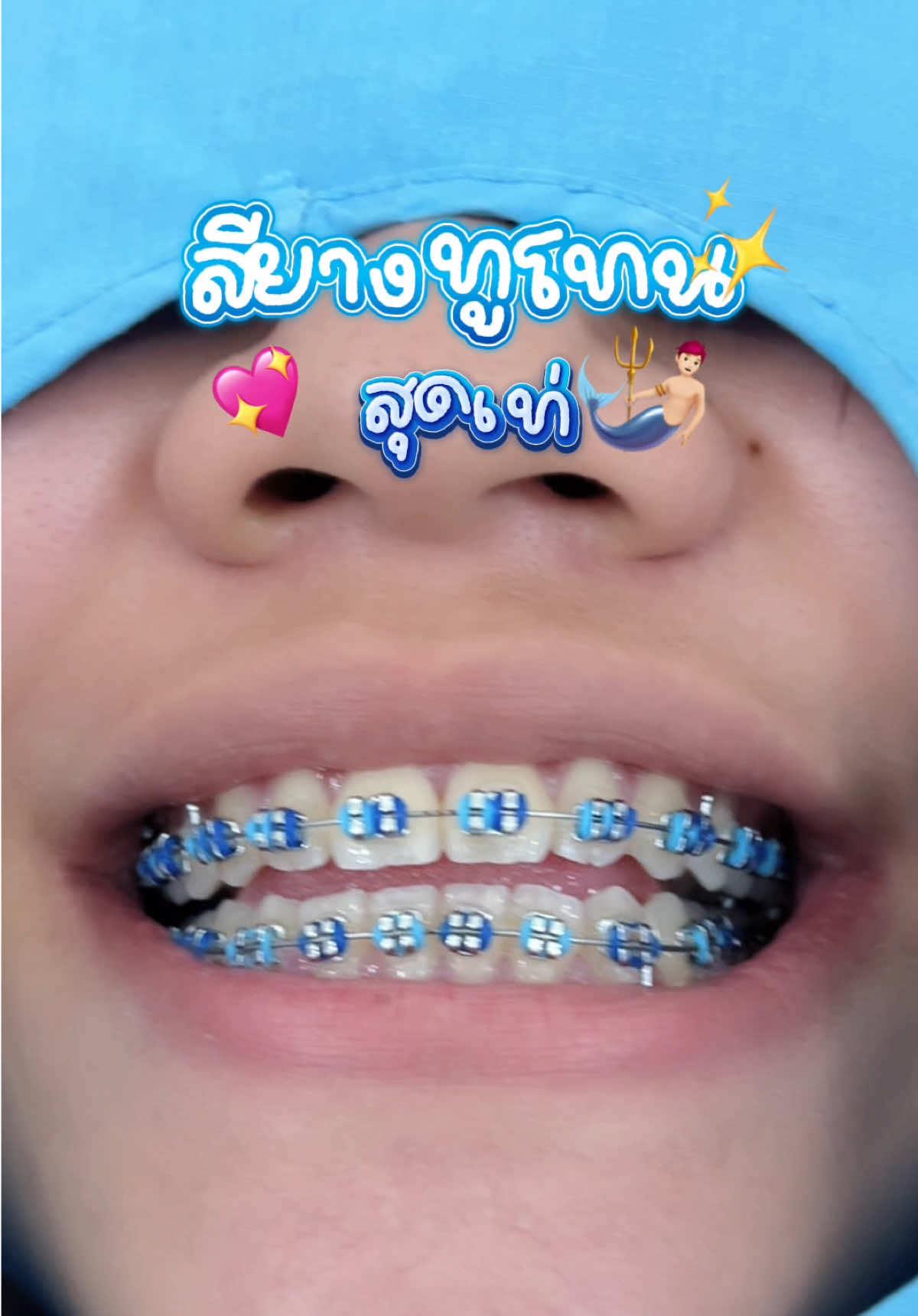 @ideasmiledentalclinic