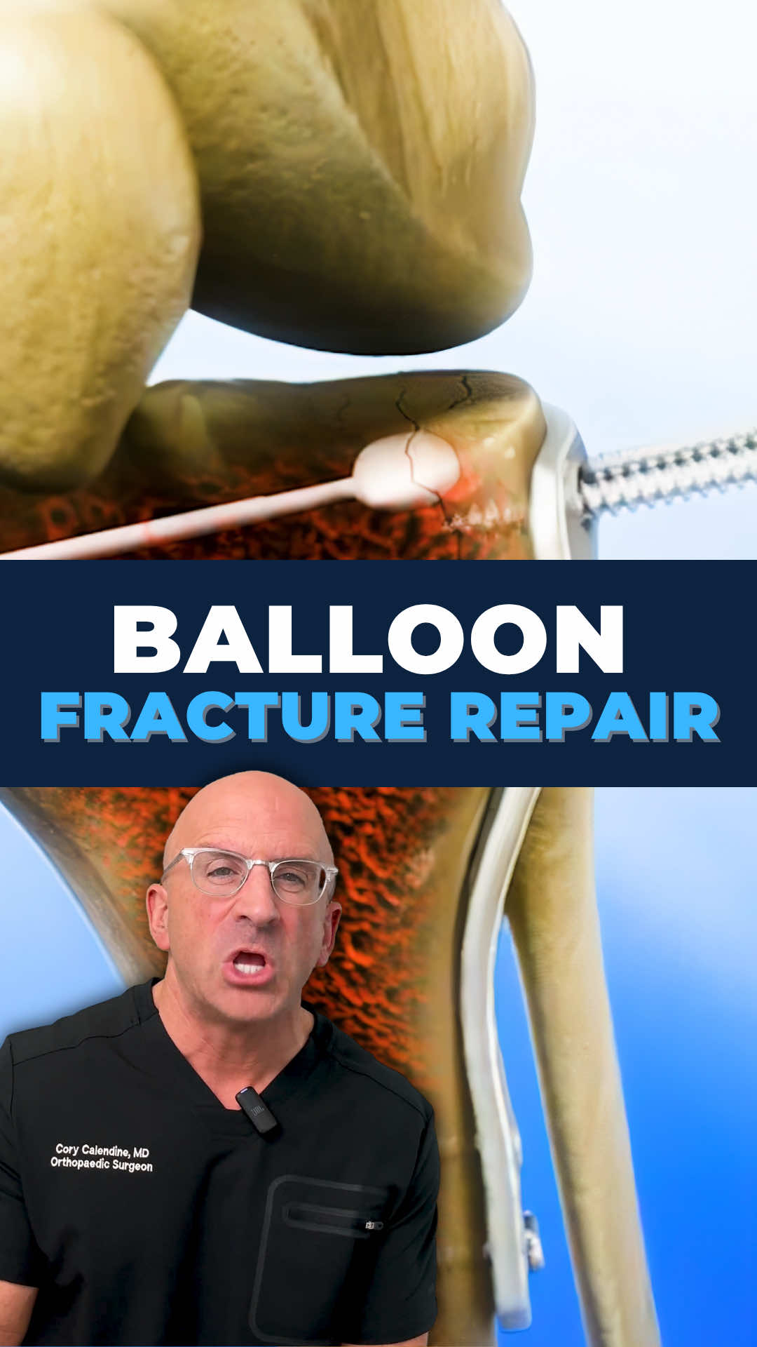 @Bone Doctor - Joint Pain MD