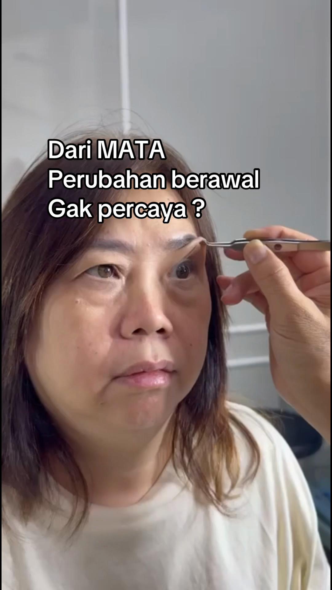 @FransHerywidjaja MD