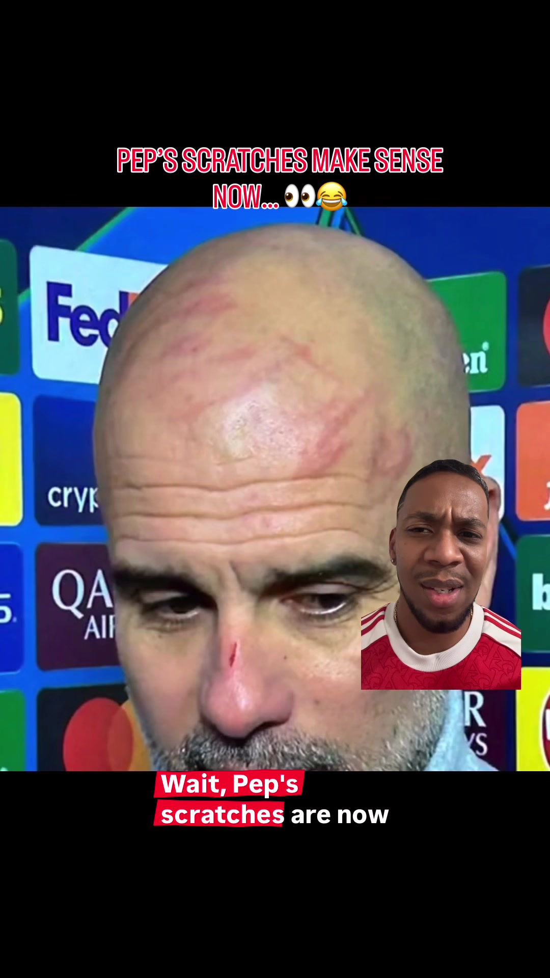 @Nev unbiased_gunner