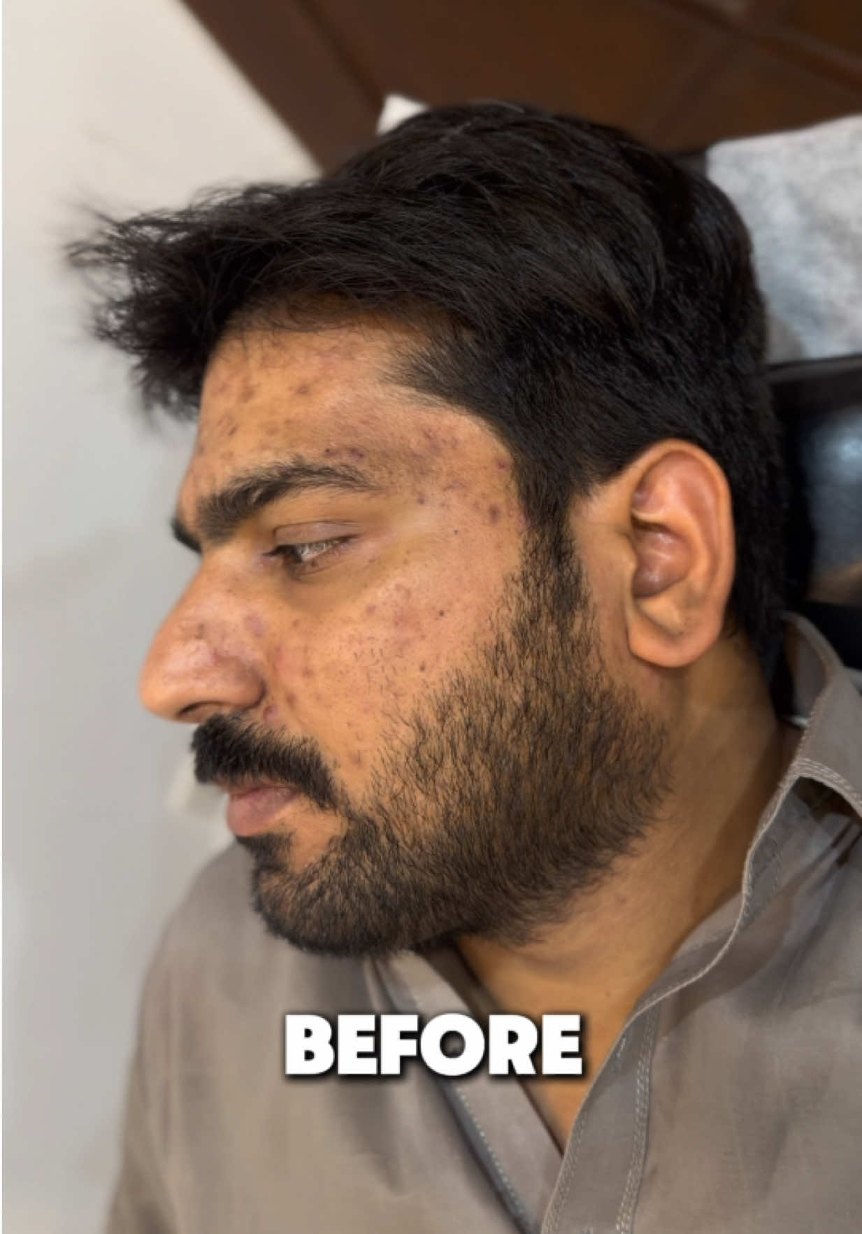 @MR Aesthetics ๐ 0325 9611110