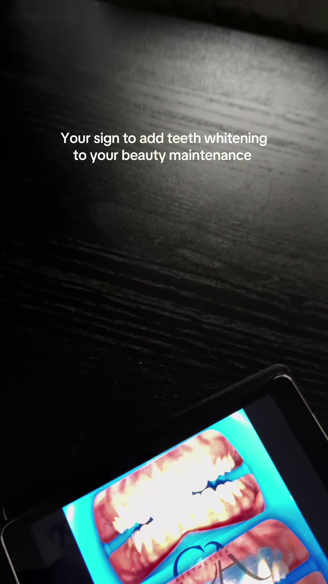 @Halal Teeth Whitening London
