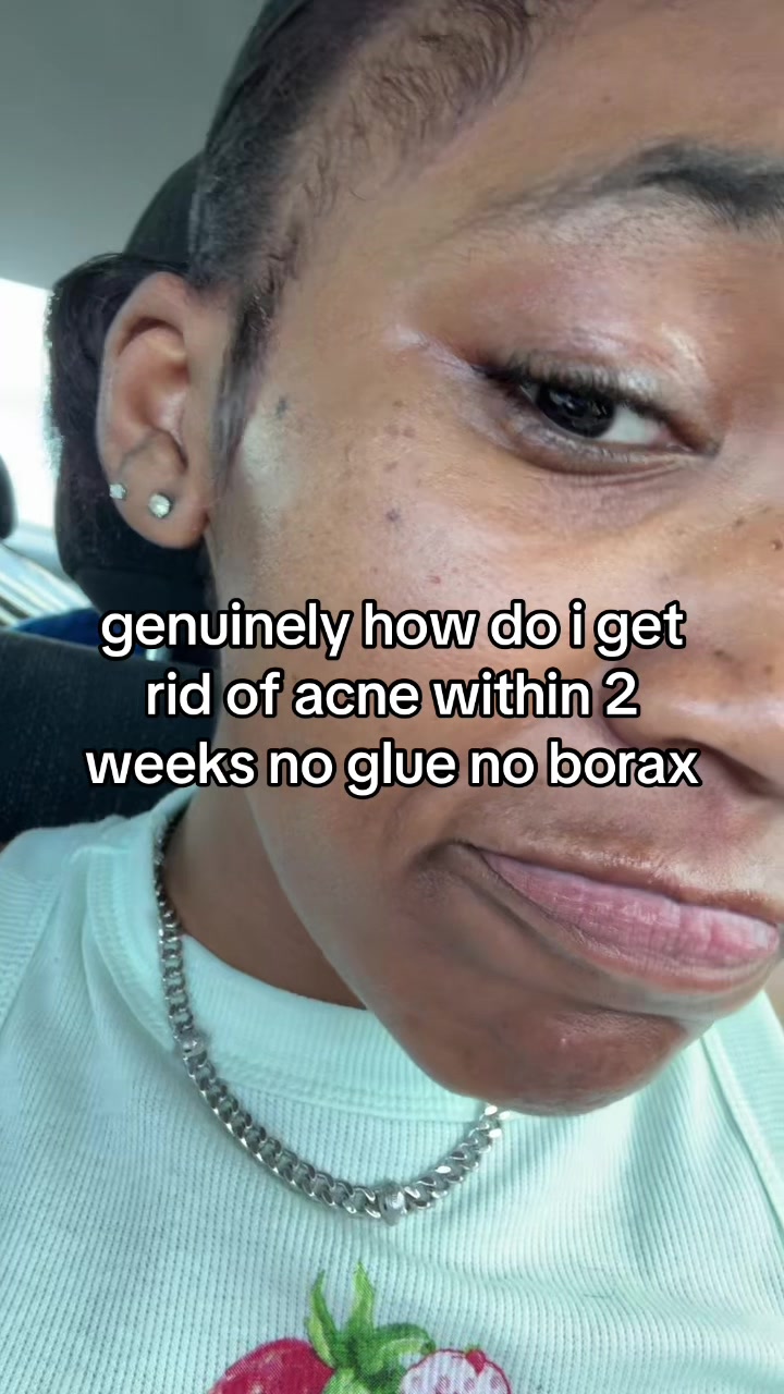 @thisnotevenmebru