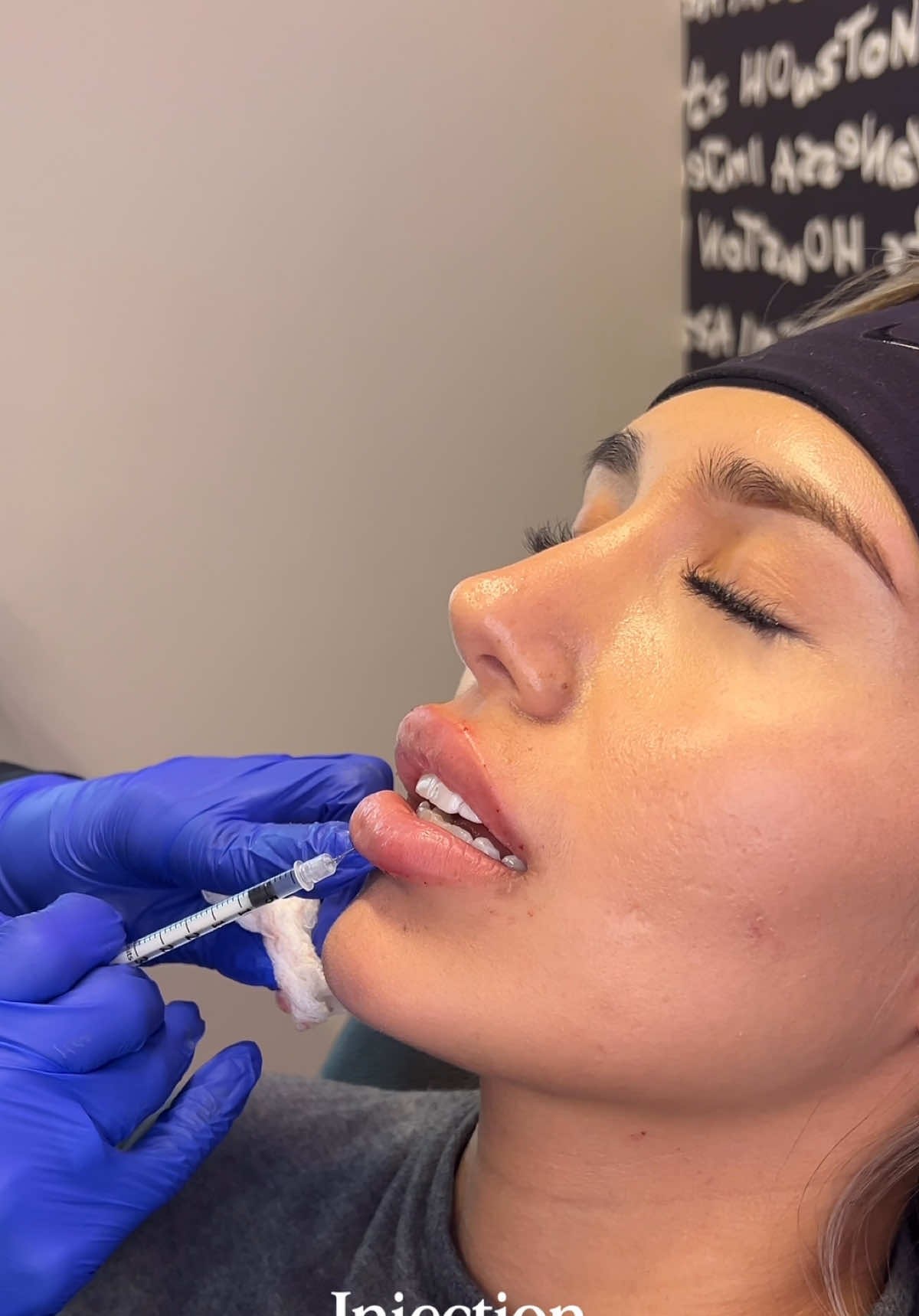 @Vanessa Injects