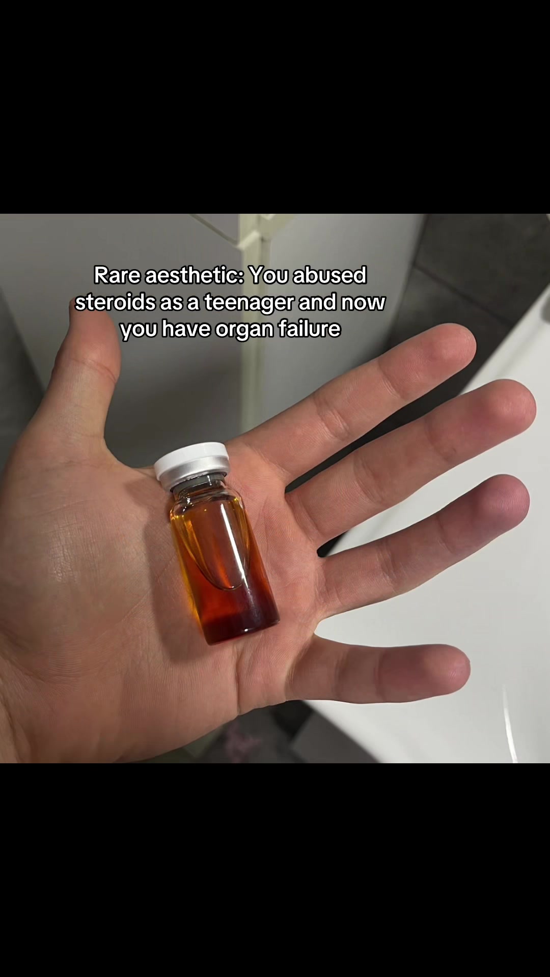 @Infraorbitalis