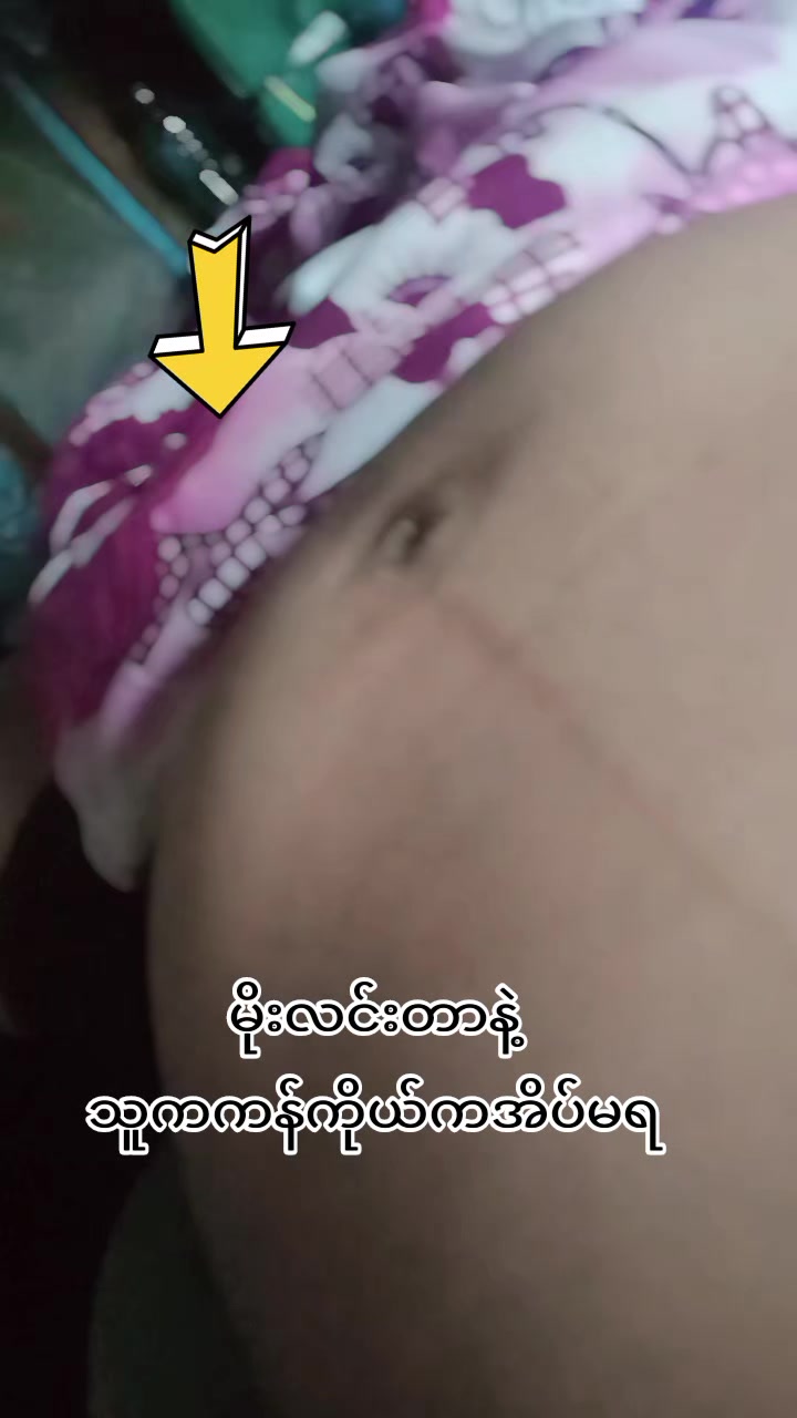 @👶မိလပြည်👶