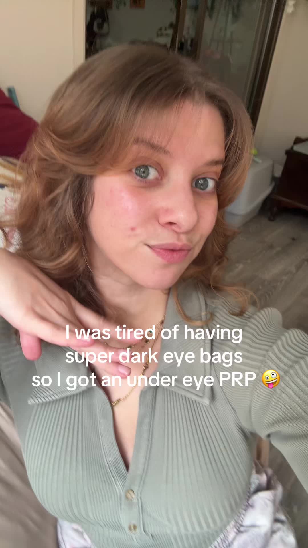 @Ash