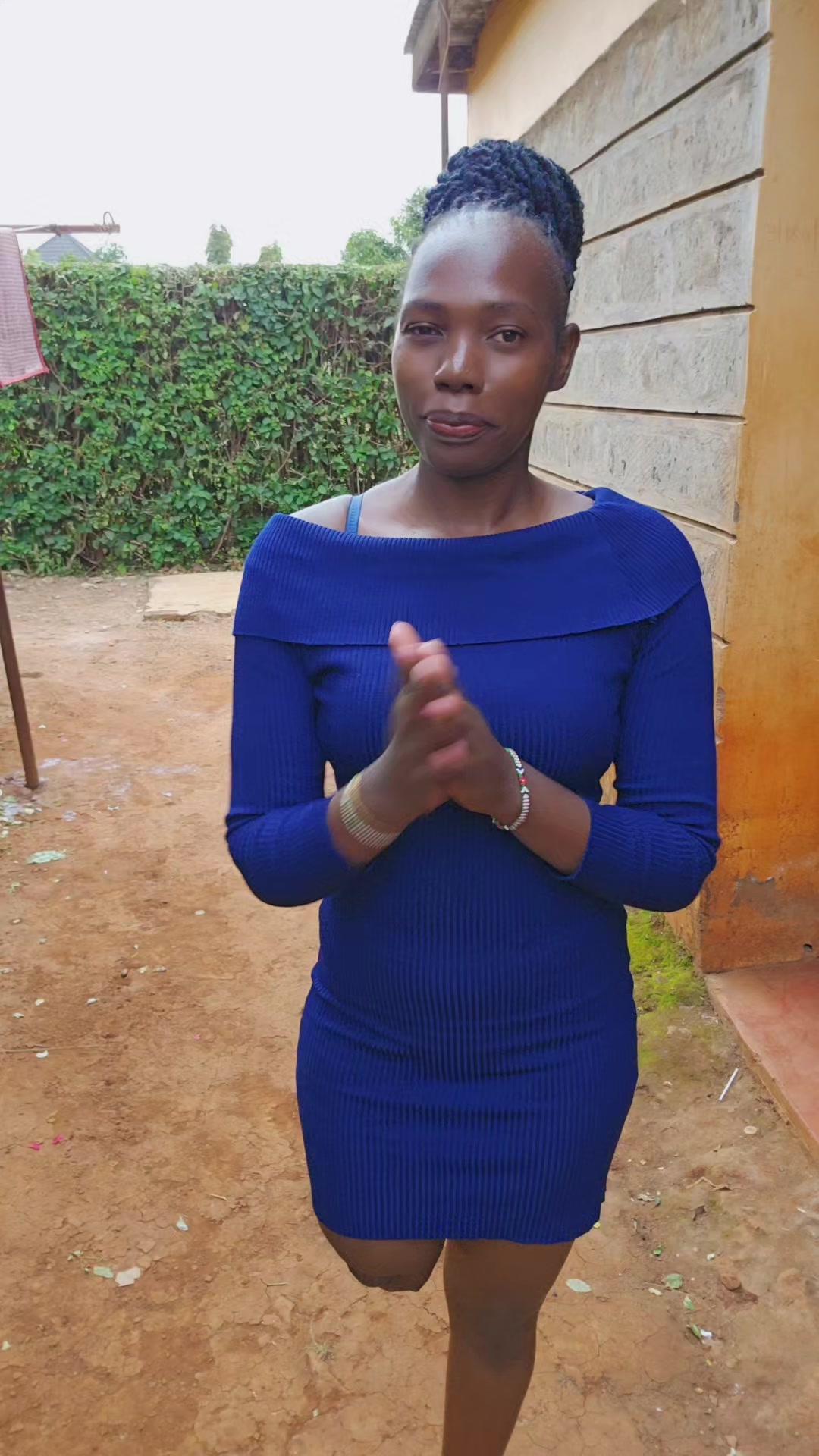 @💎Nattie Amputee🇰🇪♊️