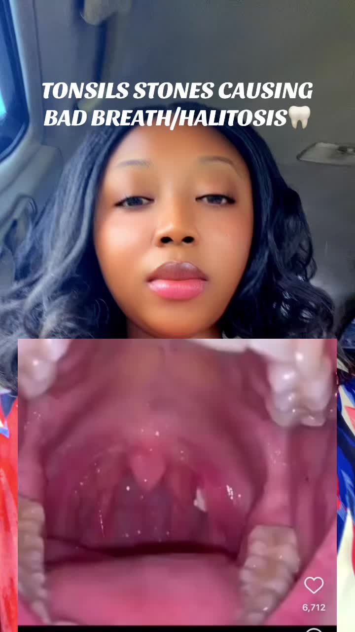 @NurseVivinelle_OralEducator🦷