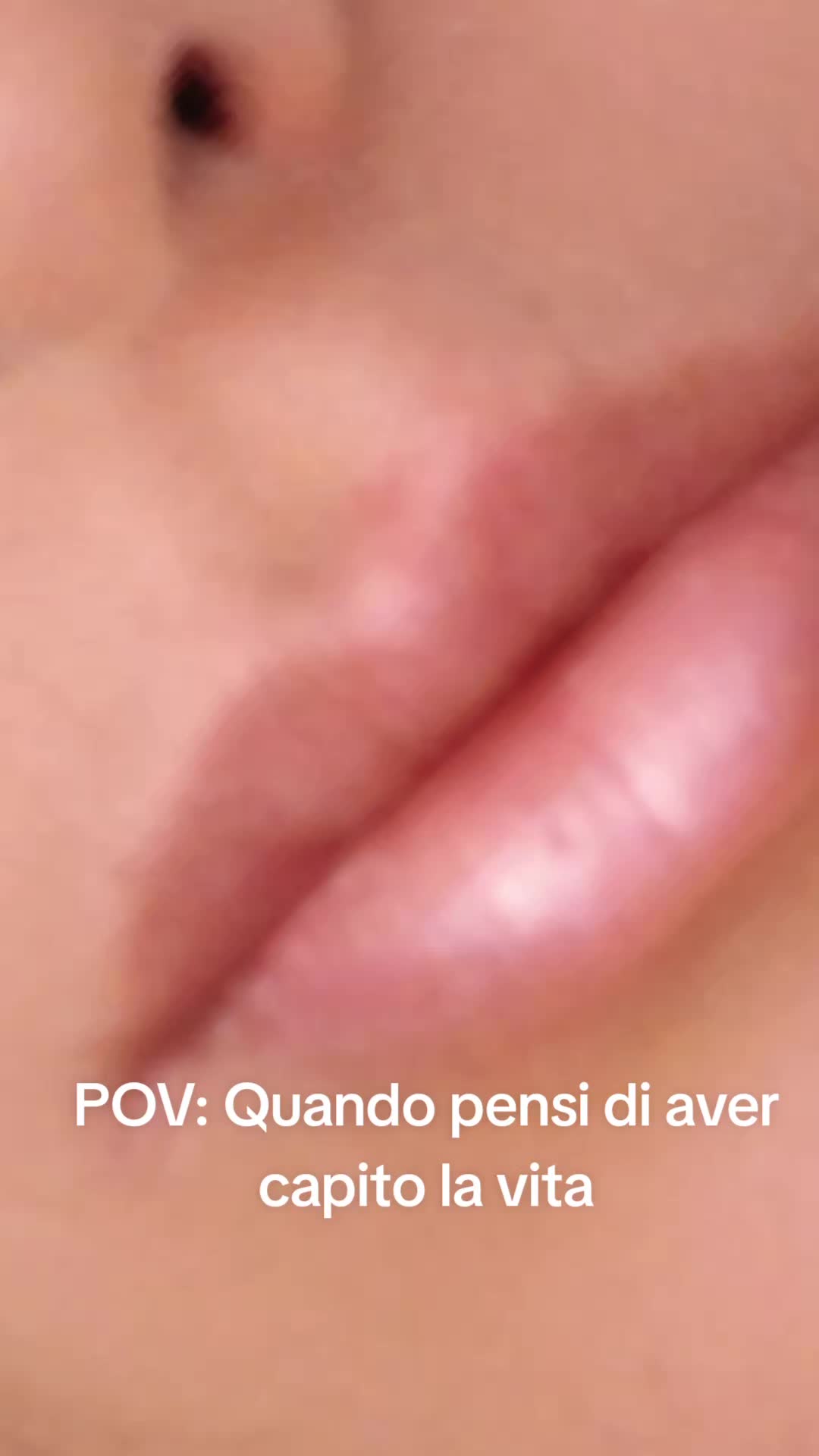 @anna