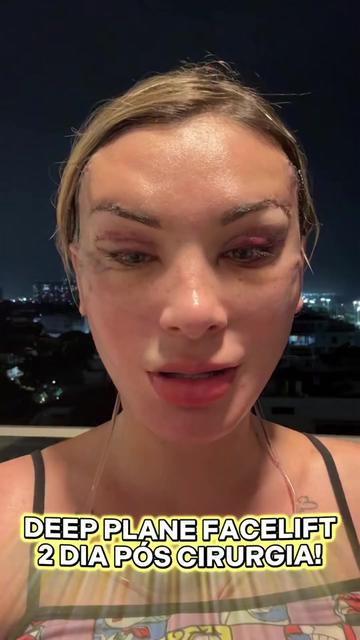 @Andressa Urach