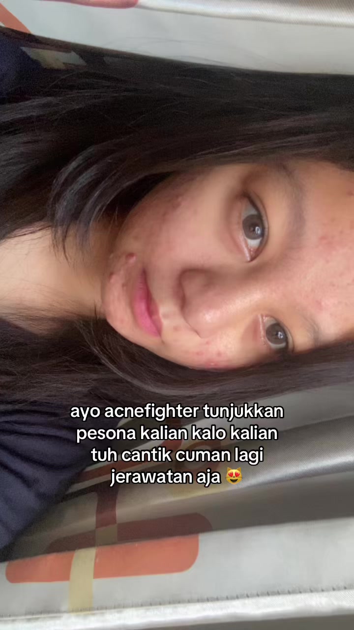 @chisin