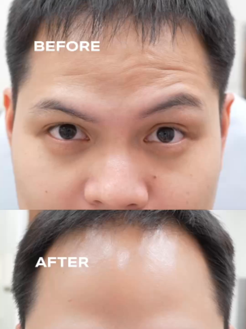 @Standard Skin clinic