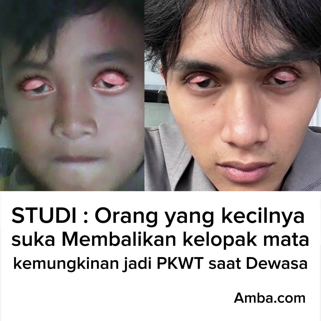 @Chandra Riyadi