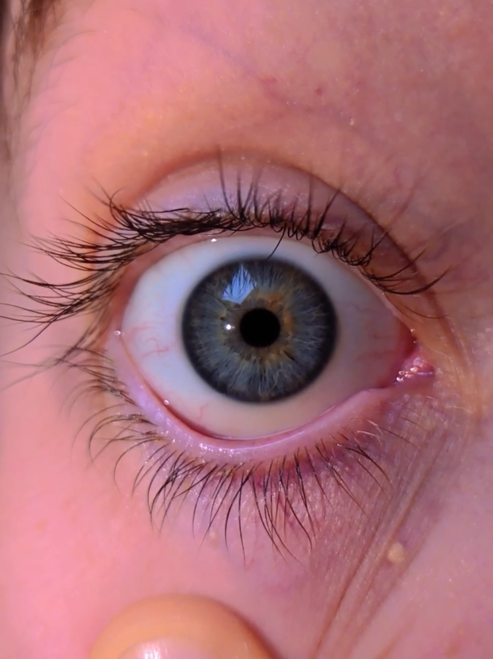 @Oliver | Aajonus' Iridology 👀