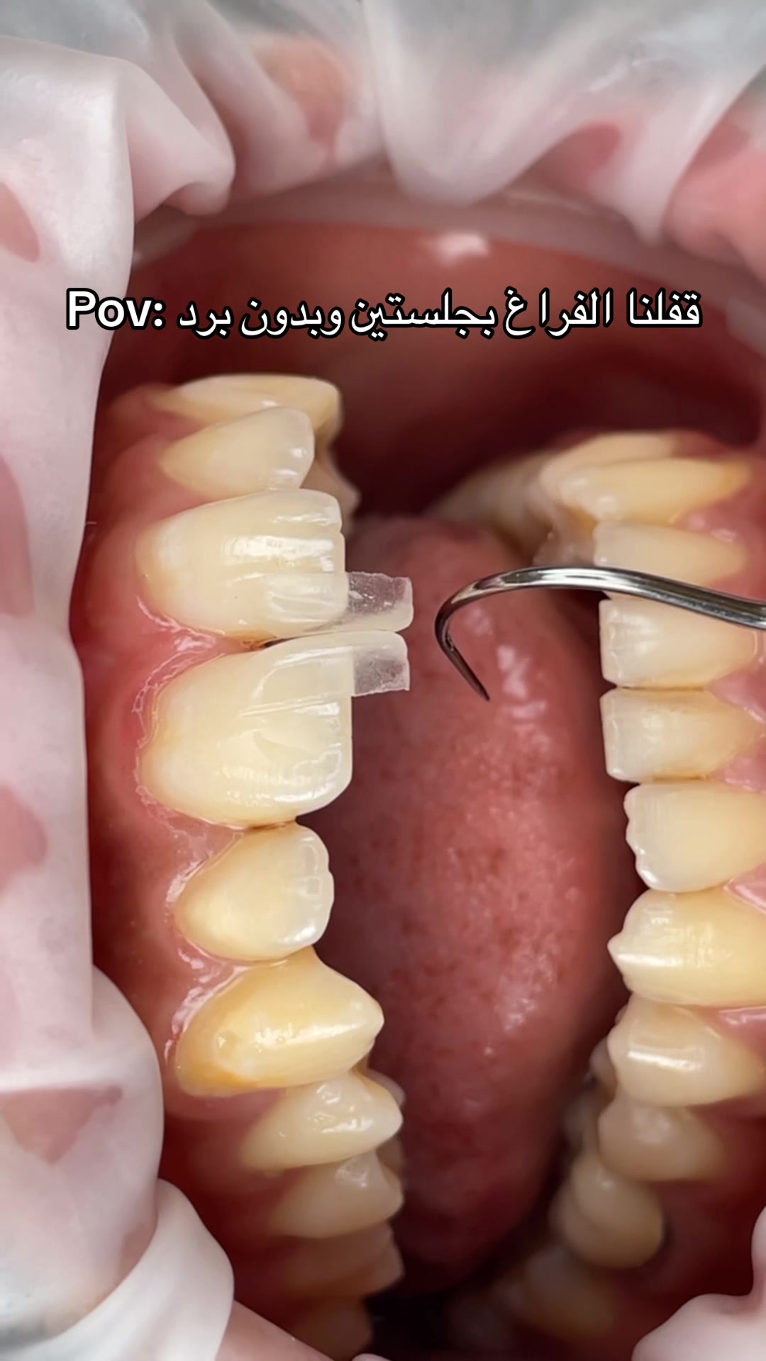 @Dr. Abrar Alhababi