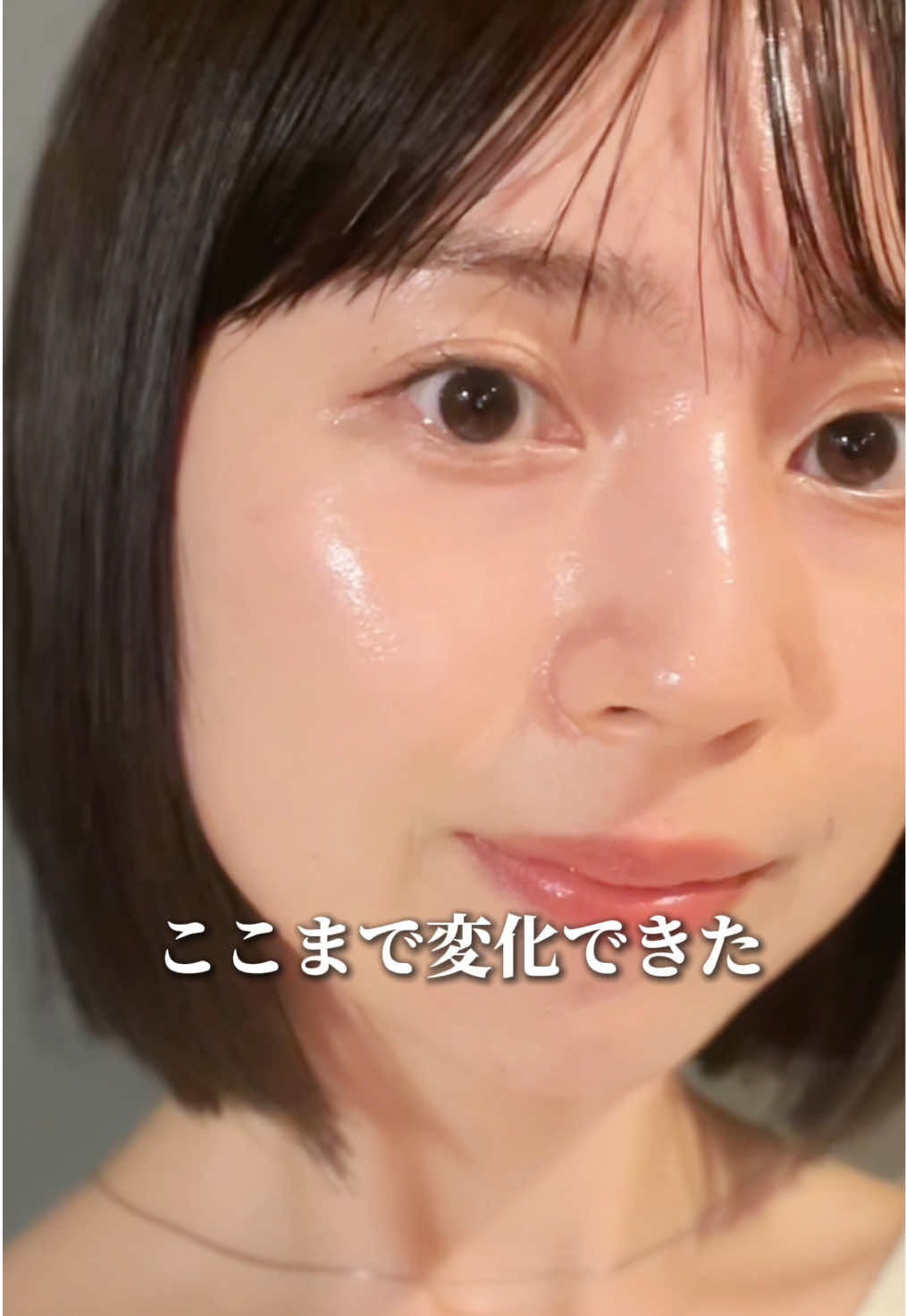 @ニキビ肌から艶肌へ🤍 ari sa