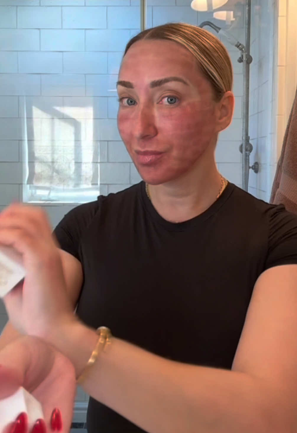 @Nicole Smith Cosmetic Injector