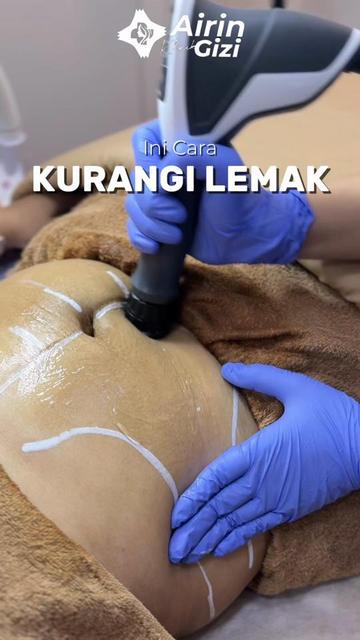 @Airin Klinik Gizi