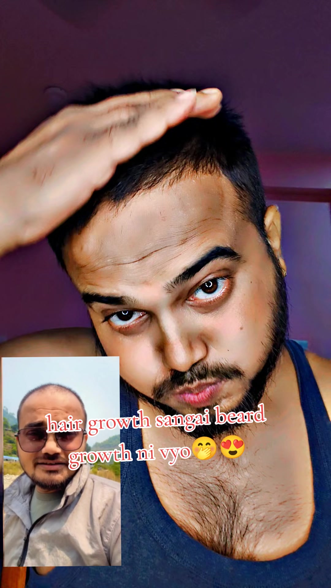 @DipeshSingh. 🕸🕷