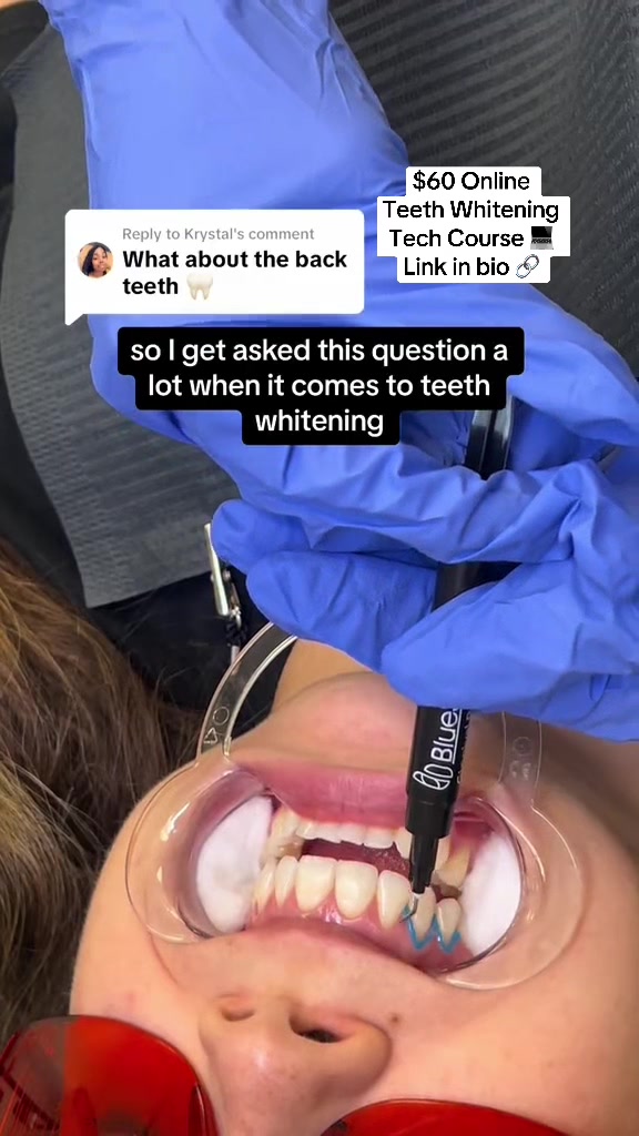@Diandra | Teeth Whitening Tech