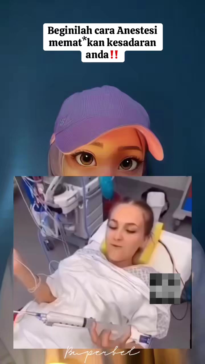 @B U P E R
