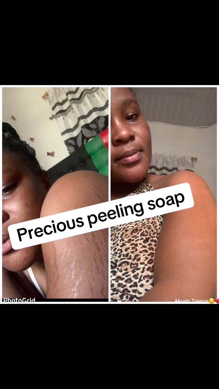 @@ Precious peeling soap