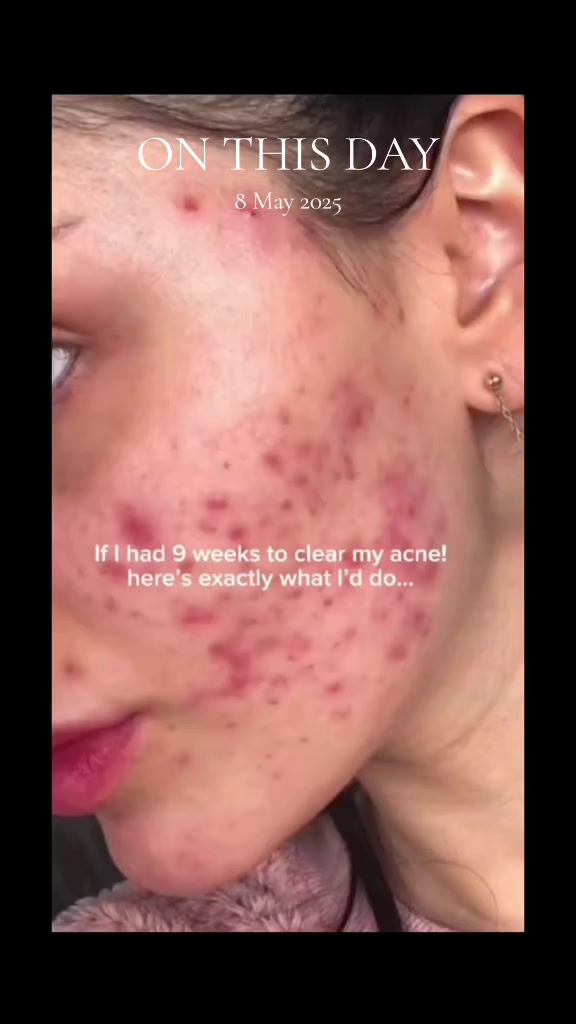 @TressEco