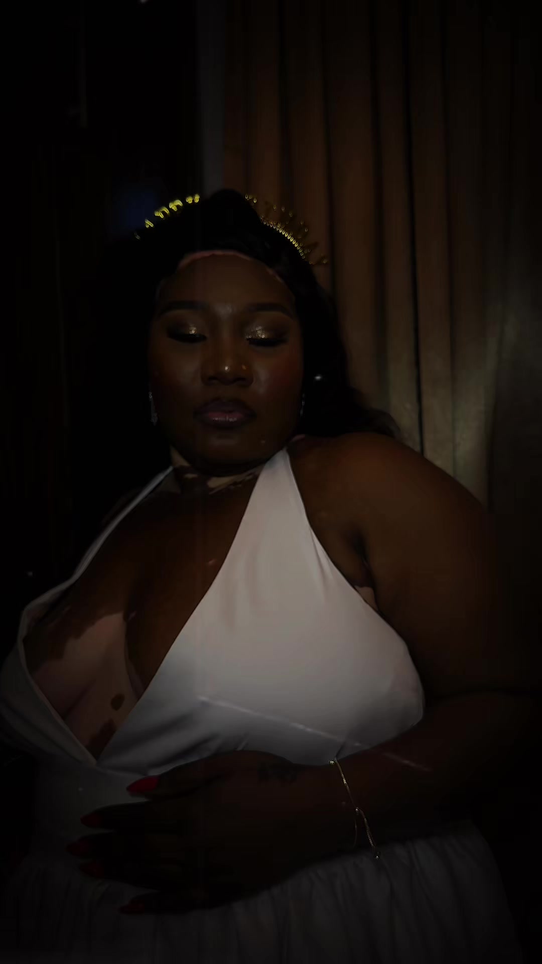 @Thevitiligogirl