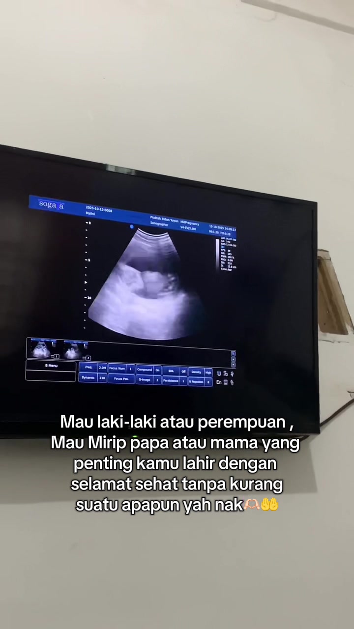 @𝒍𝒊𝒏𝒐𝒕_