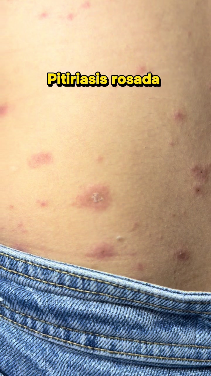 @dr.idrogodermatologo
