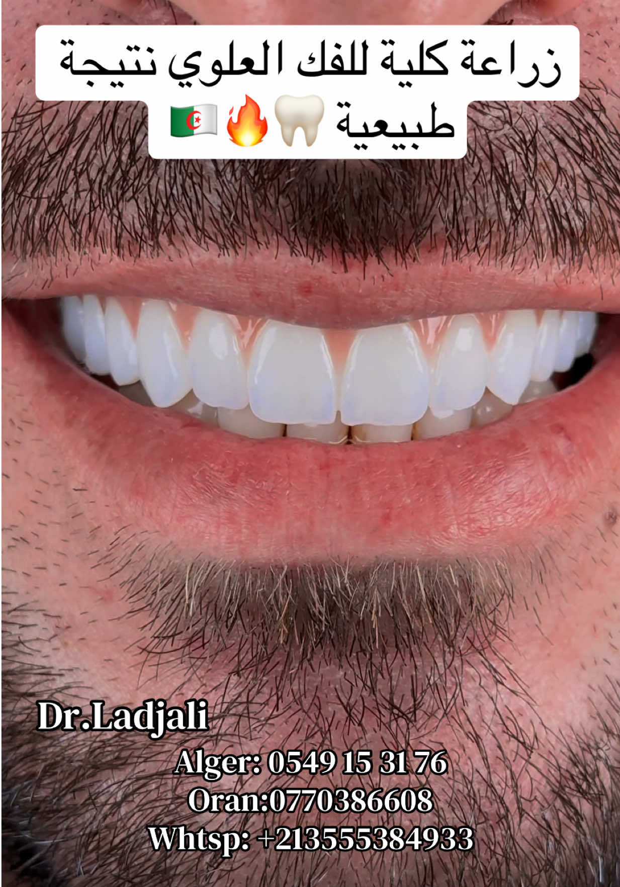 @Dr.ladjali