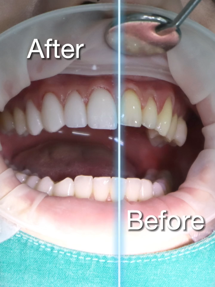 @BangkokSmileDentalClinic